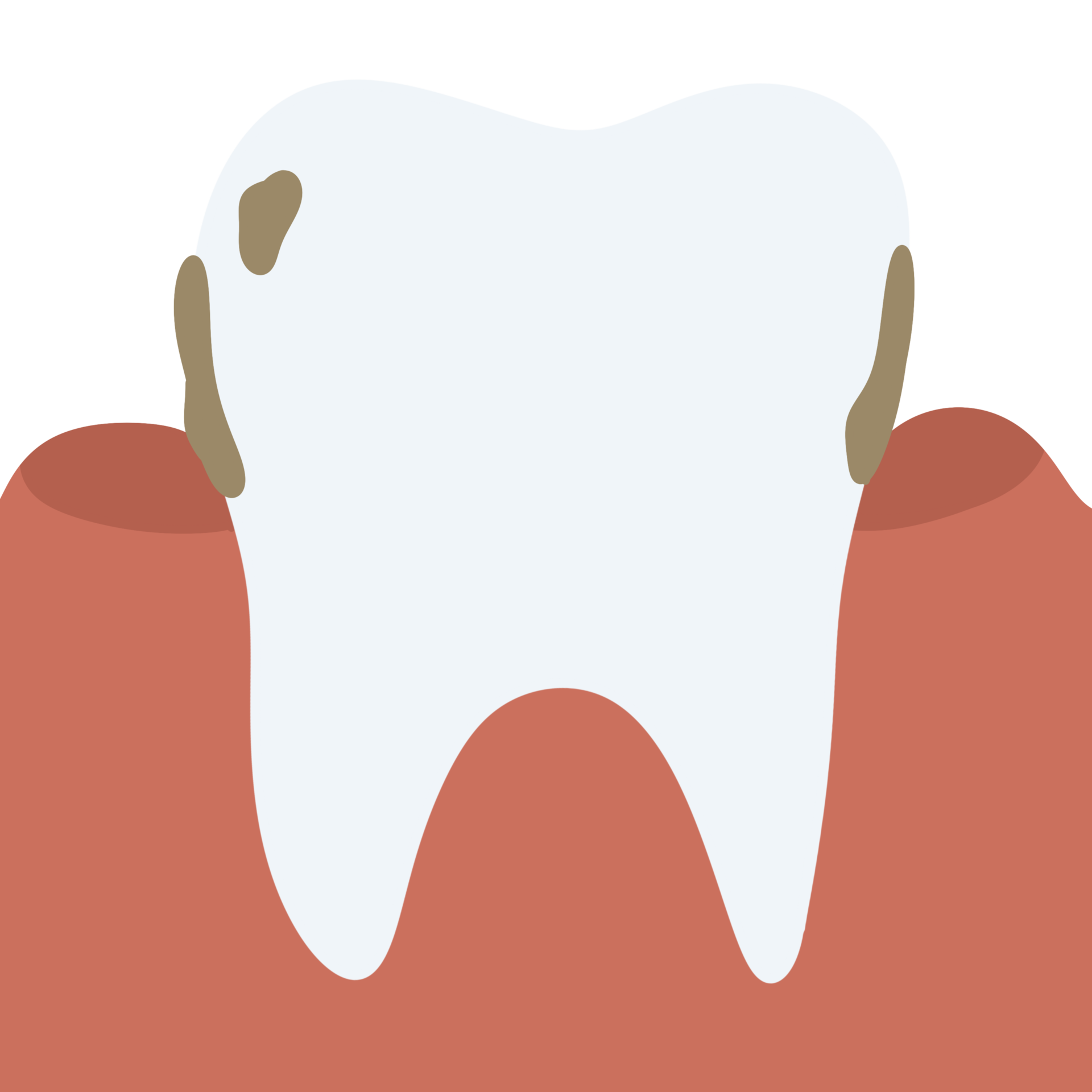 Tooth decay plaque gum disease toothache 26517422 PNG