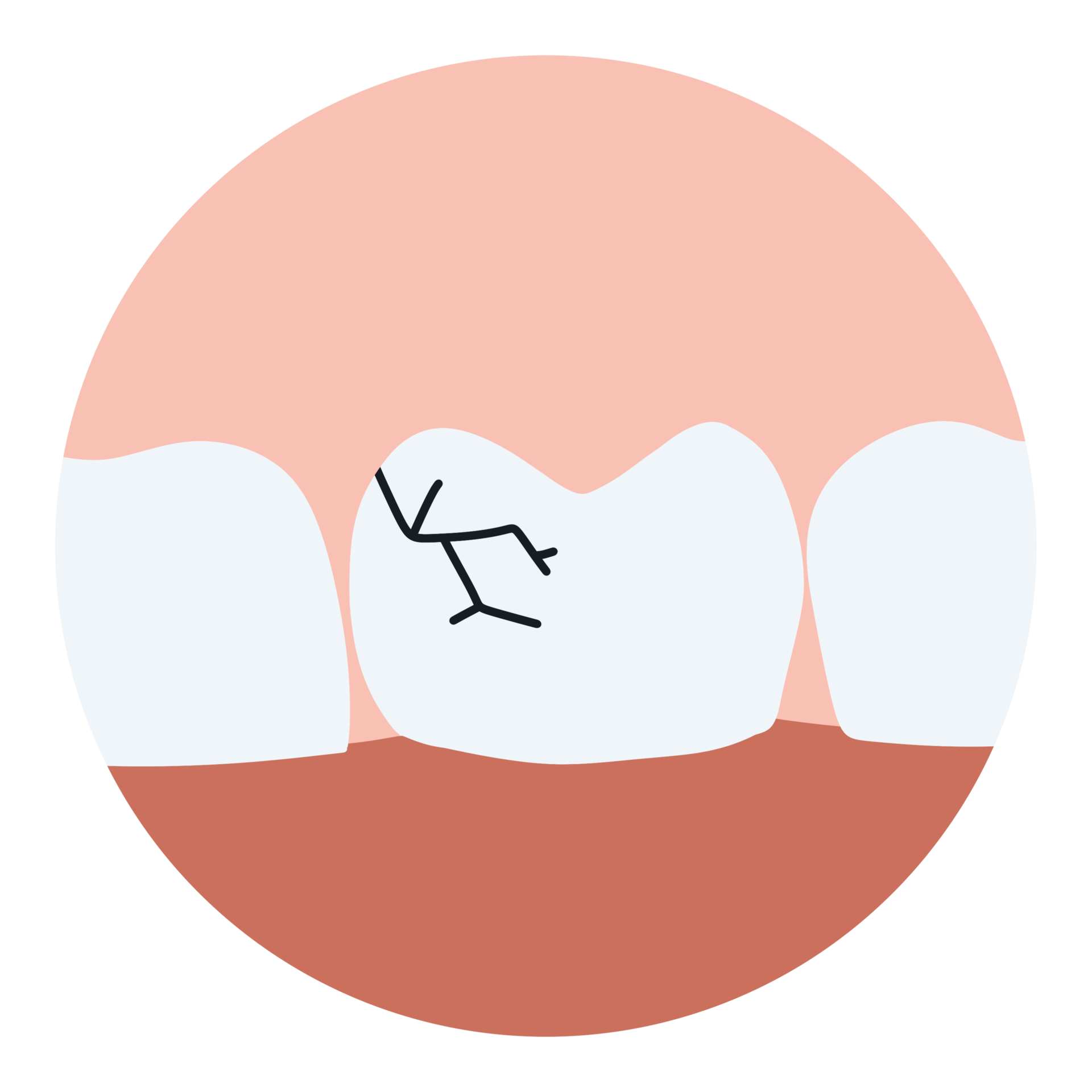 The Surprising Link Between No See Ums And Tooth Decay - req7un0