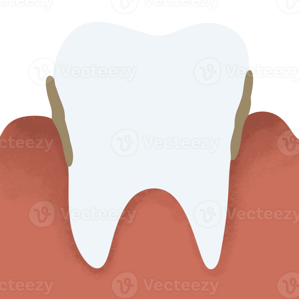 dente decair placa Chiclete doença dor de dente png