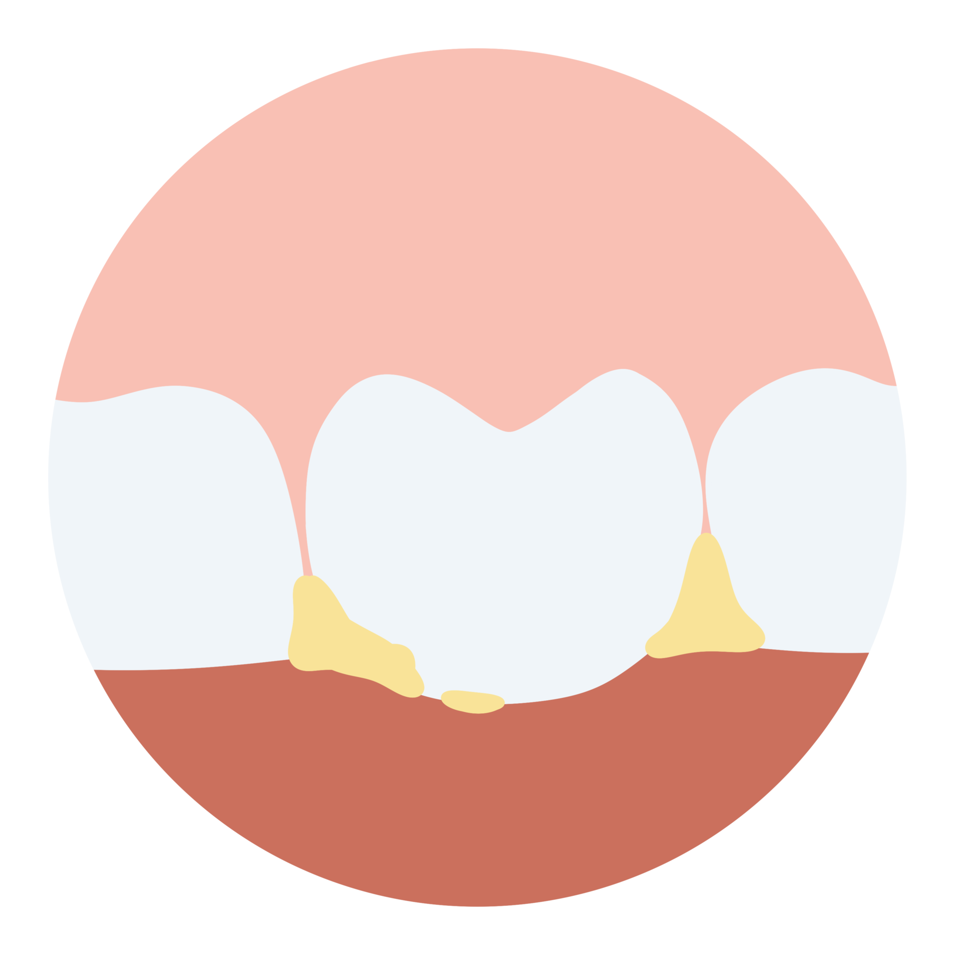 Tooth decay plaque gum disease toothache 26518326 PNG