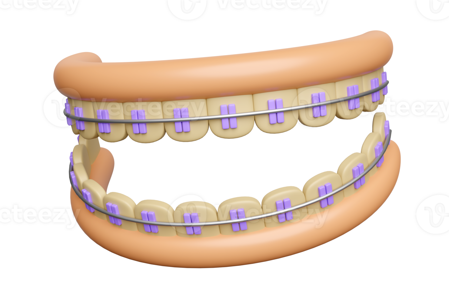 3d orthodontics cartoon, teeth braces with gum isolated. 3d render illustration png