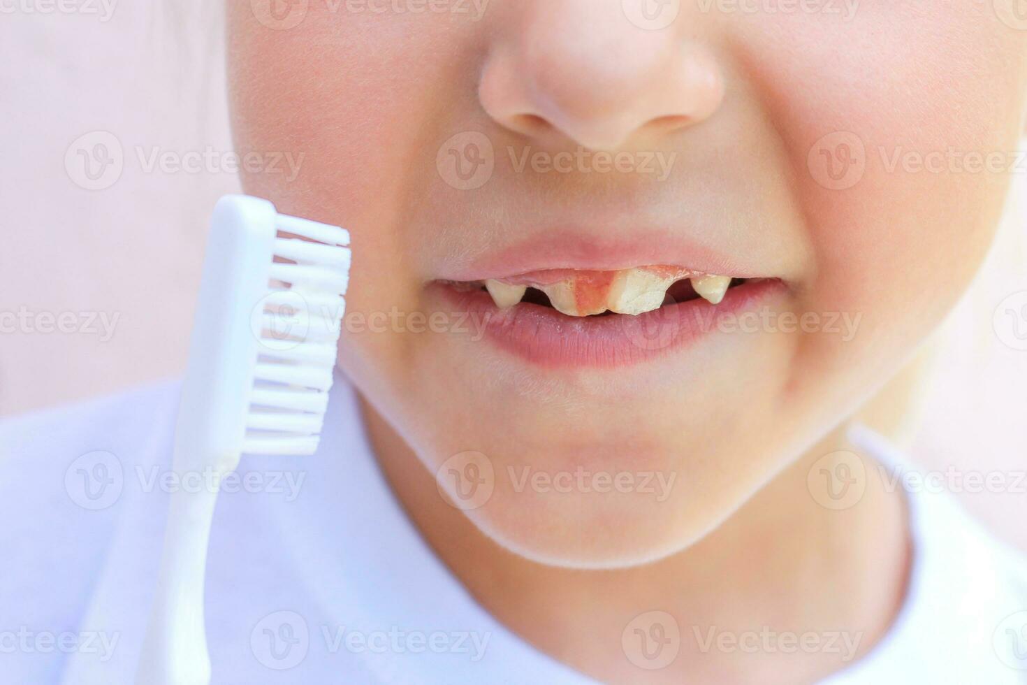 sangre en el dientes de un niño. foto