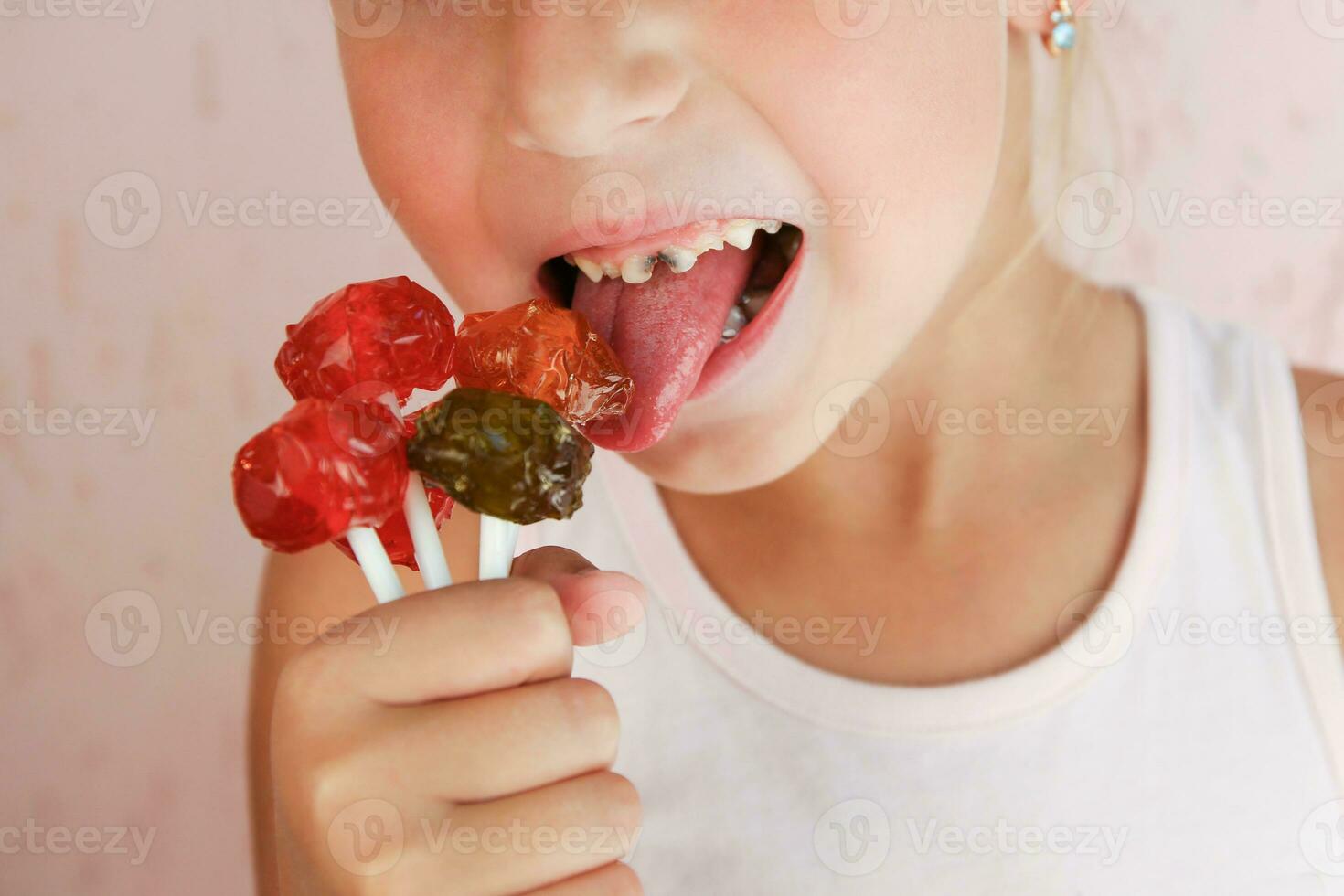 Child eats candy. Girl has caries on teeth. photo