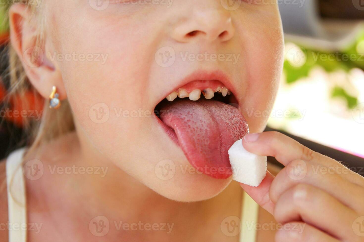 niño come azúcar. niña tiene caries en dientes. foto