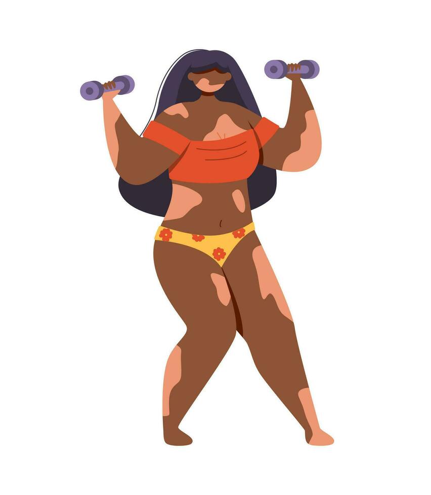 An African American woman with vitiligo exercises with small dumbbells. vector