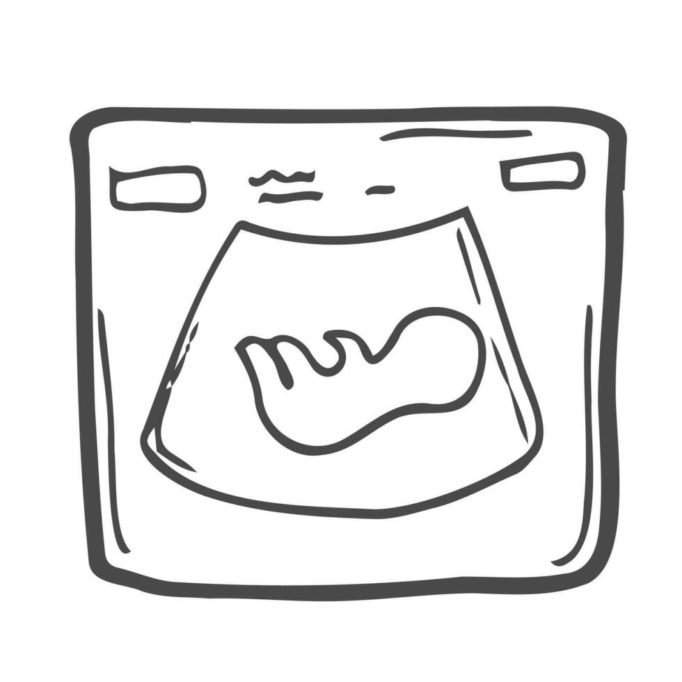 Fetal ultrasound hand drawn outline doodle icon. Pregnancy sonogram of a fetus in womb vector sketch illustration for print, web, mobile and infographics isolated on white background.