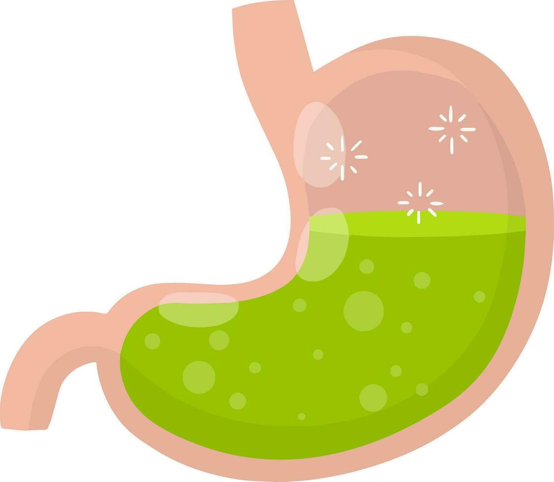 Human stomach. Internal organ of body. Bubbles in acid. X-ray of belly. Digestive problems. Cartoon flat illustration. Medical care vector