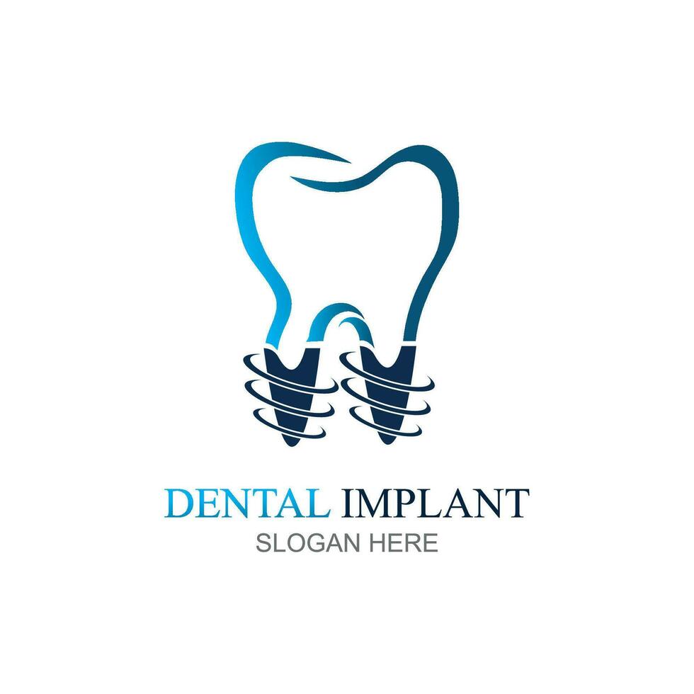 Dental implant logo design concept vector, Dental Care logo template vector