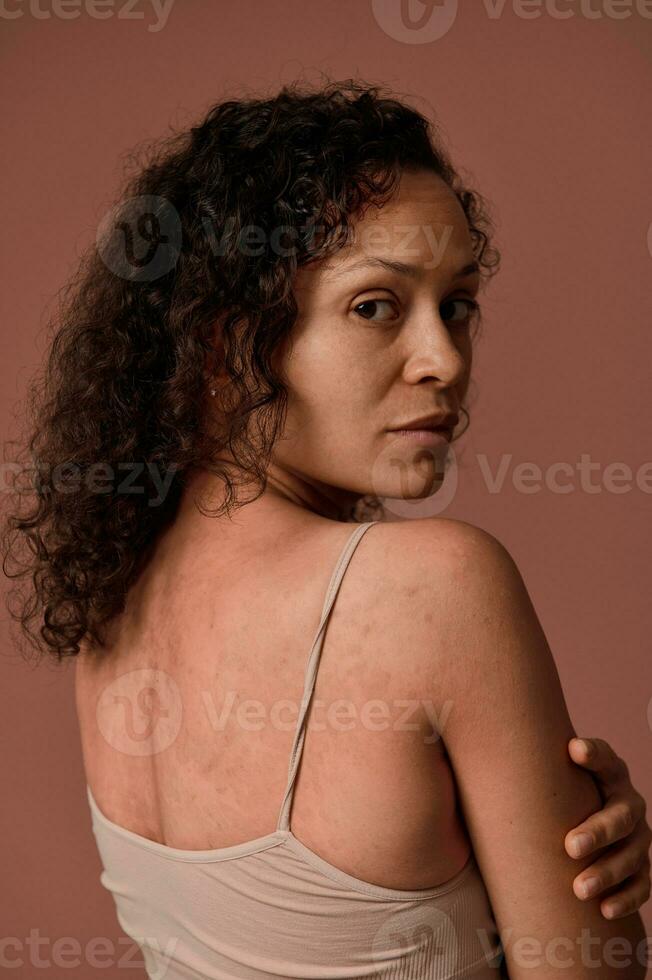 cerca arriba retrato en de colores antecedentes con Copiar anuncio espacio de un bonito mujer en beige parte superior abrazando sí misma mirando a el cámara demostración piel problemas en su atrás. dermatología, cuerpo positivo foto