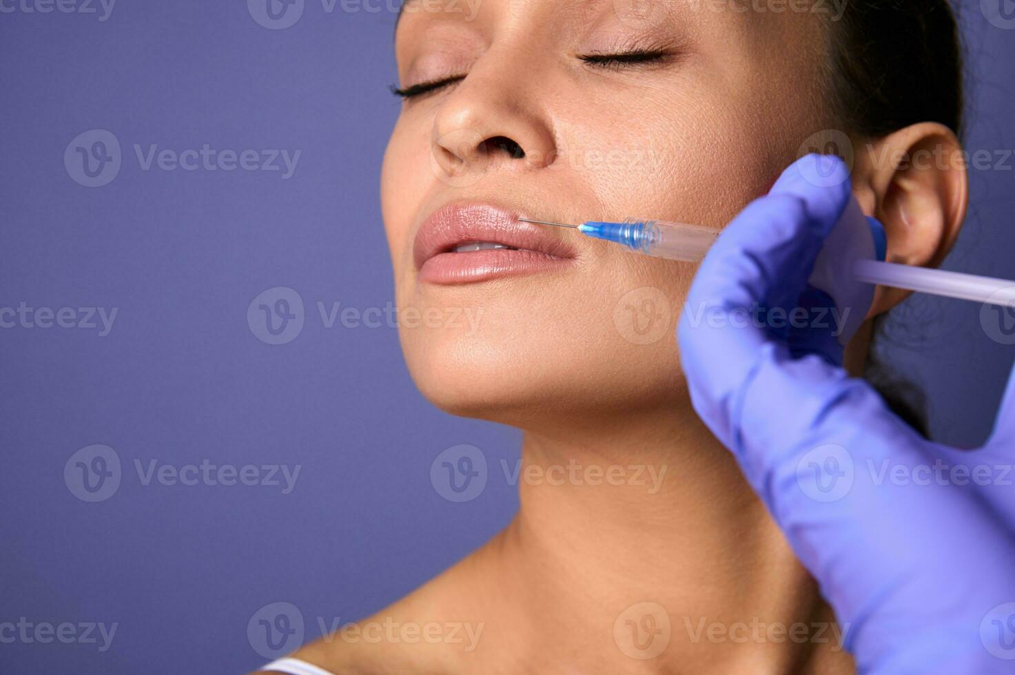 Dark-haired charming natural beauty woman with perfect clean healthy skin receiving beauty injection on her lips. Lips augmentation and correction concept. Aesthetic cosmetology and surgery. Close-up photo