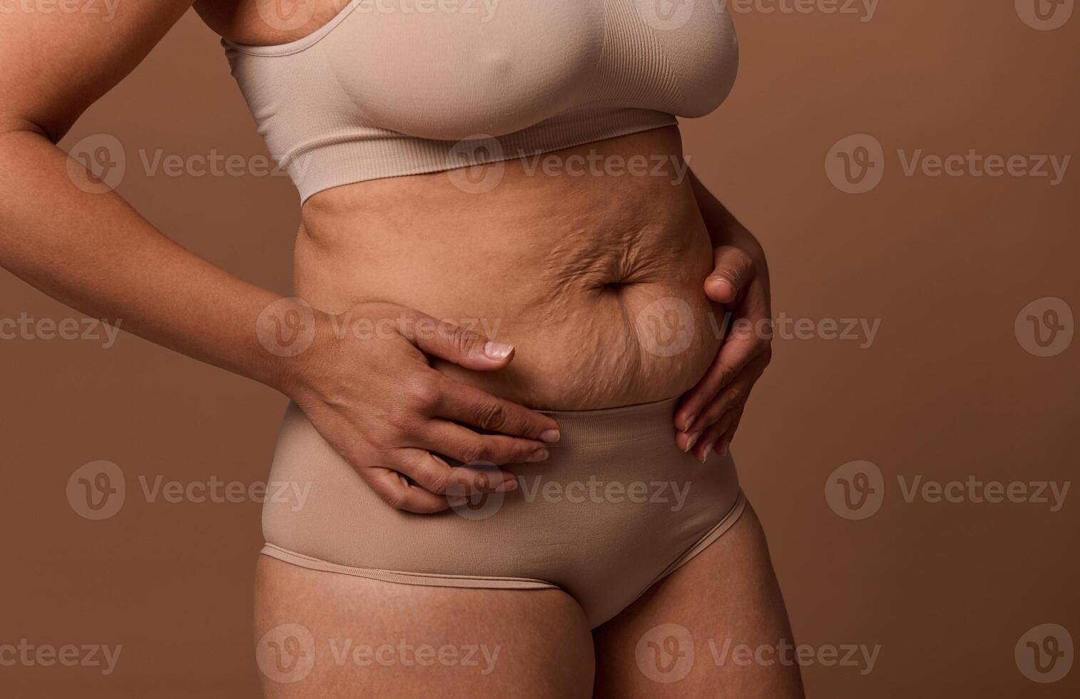 Woman body with stretch marks on the skin after childbirth. The concept of love and acceptance of yourself and your body. Body positive photo