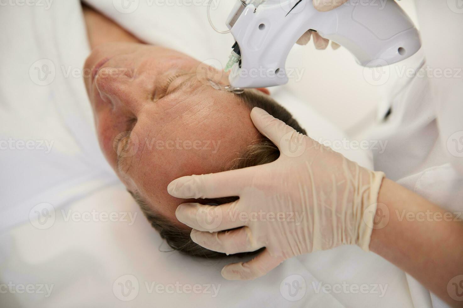 Overhead view of a handsome aged man lying on massage table during mesotherapy gun therapy in modern spa clinic. Anti-aging, rejuvenation and alternative beauty treatment to prevent first wrinkles photo