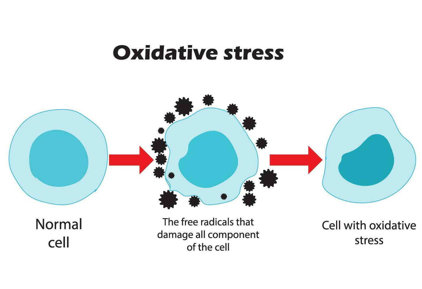 oxidativo estrés. desde normal células, a oxidativo estrés y agresivo gratis radicales, a célula muerte.educativa y estudiar contenido para estudiantes de biología, medicina y ciencia. vector ilustración.