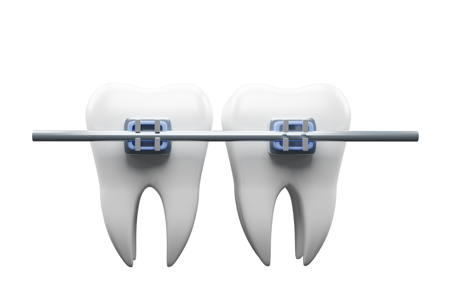 les dents croisillons. les dents alignement. les dents avec un appareil dentaire . 3d rendre. png
