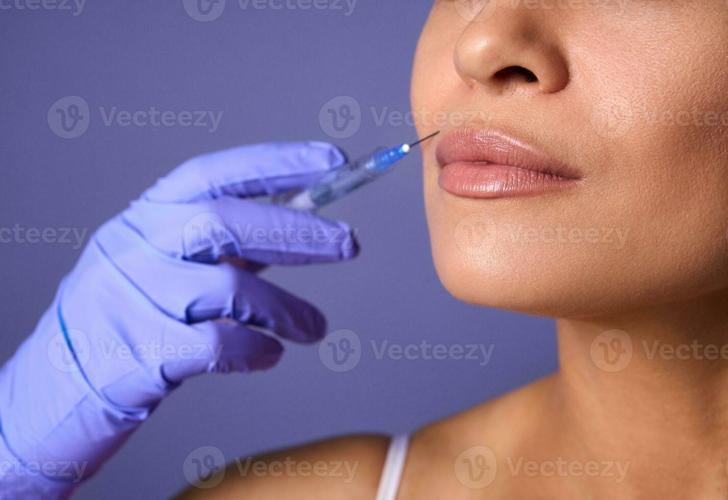 inyección cosmetología, estético cirugía, labios aumento y corrección concepto. de cerca de mujer cara y mano en quirúrgico guante participación jeringuilla cerca su labios, Listo a recibir belleza tratamiento foto