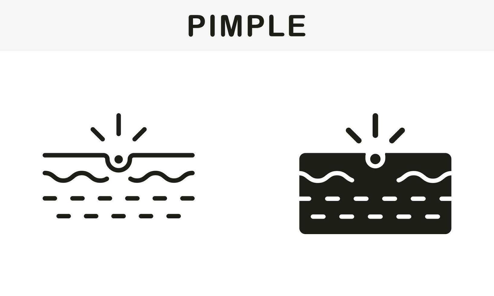 piel acné, inflamación sebo, comedón pictograma. espinilla línea y silueta negro icono colocar. espinilla, profundo pústula piel problema símbolo recopilación. aislado vector ilustración.