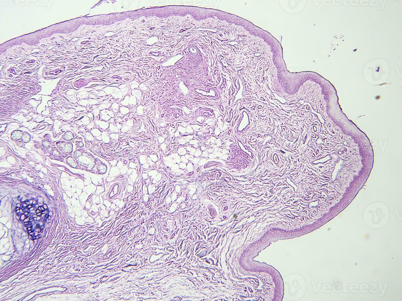 histology human tissue with microscope from laboratory photo