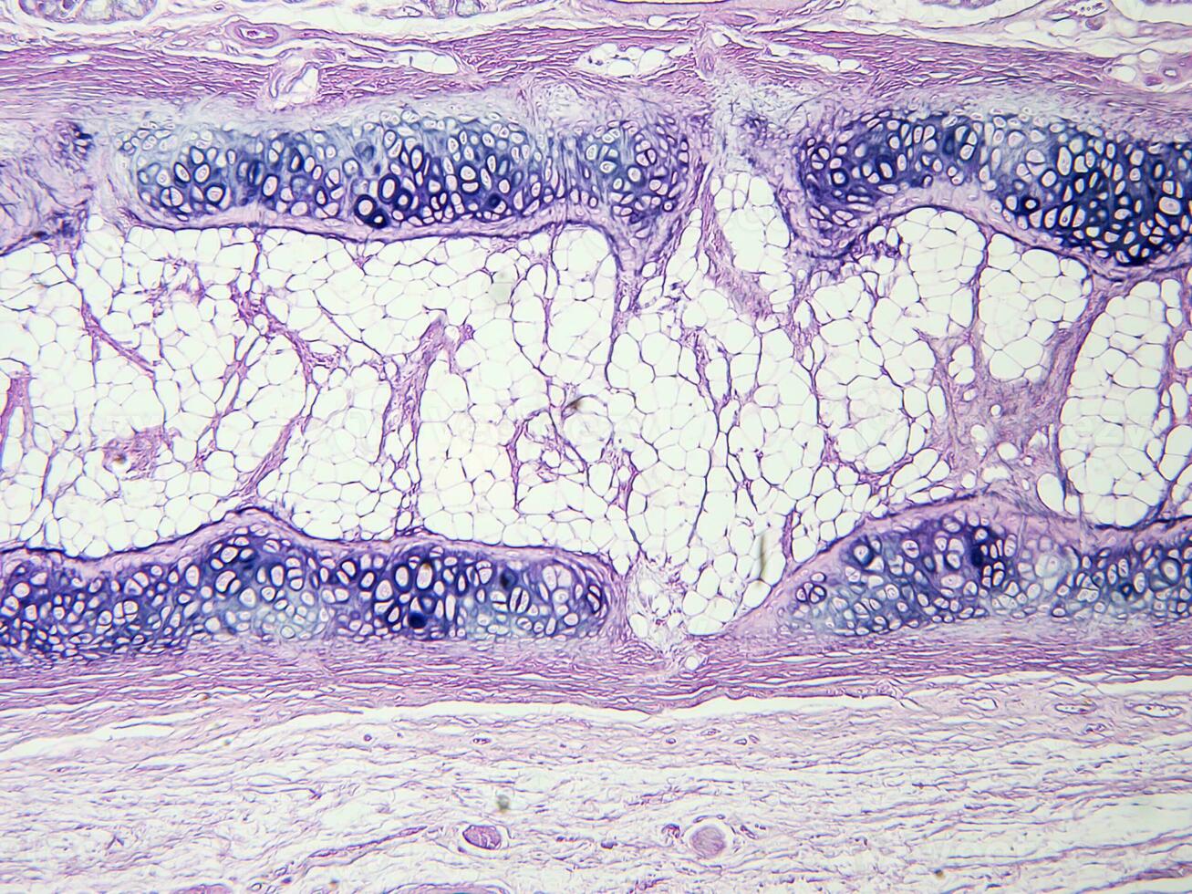 histology human tissue with microscope from laboratory photo