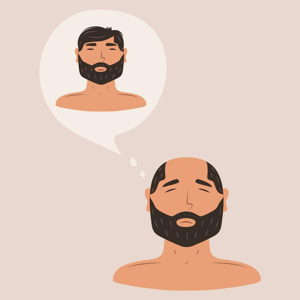 Flat vector illustration with memories of a man before baldness, hair loss, alopecia at a young age, hair problems, baldness.