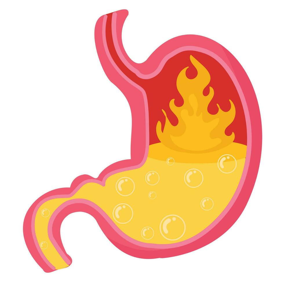 Human stomach ache digestive problems. 27508336 Vector Art at Vecteezy