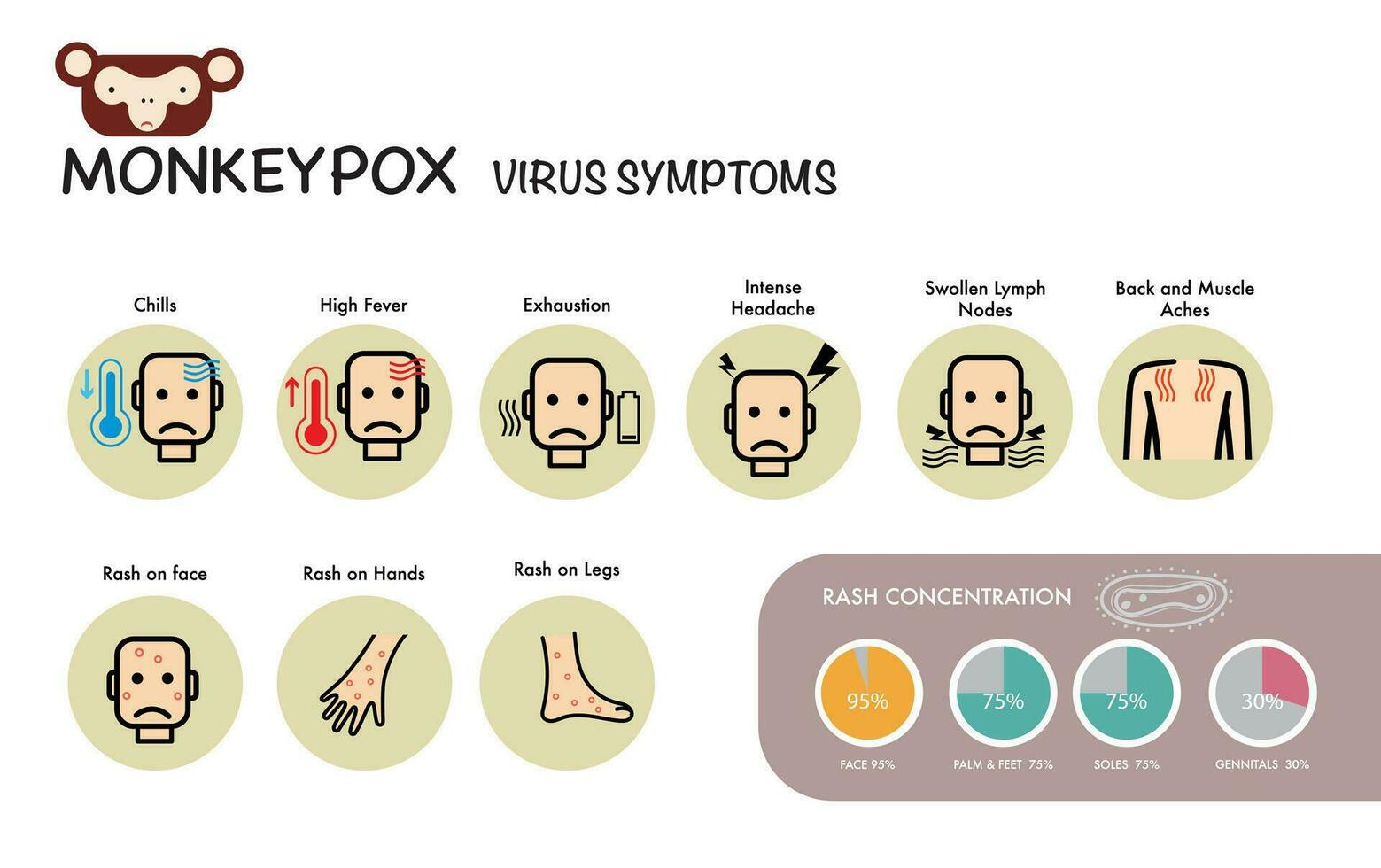 monkeypox virus symptoms pandemic Infographic chart vector
