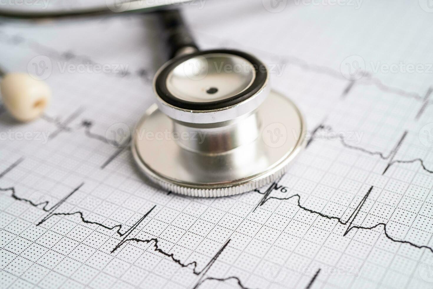 estetoscopio en electrocardiograma ecg, onda cardíaca, ataque cardíaco, informe de cardiograma. foto