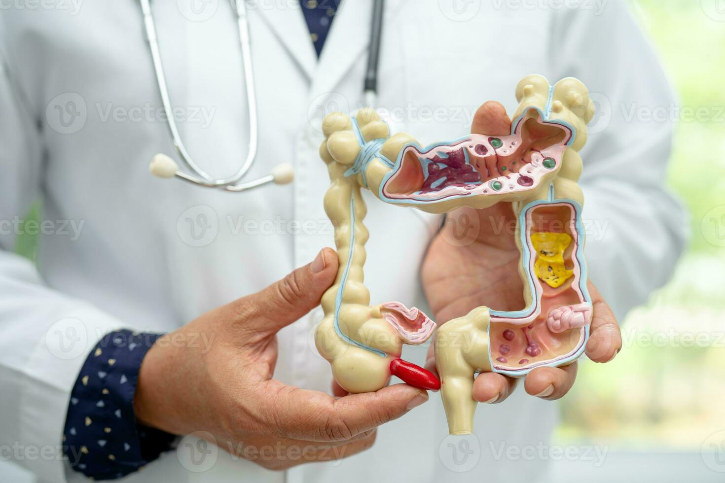 Intestine, appendix and digestive system, doctor holding anatomy model for study diagnosis and treatment in hospital. photo