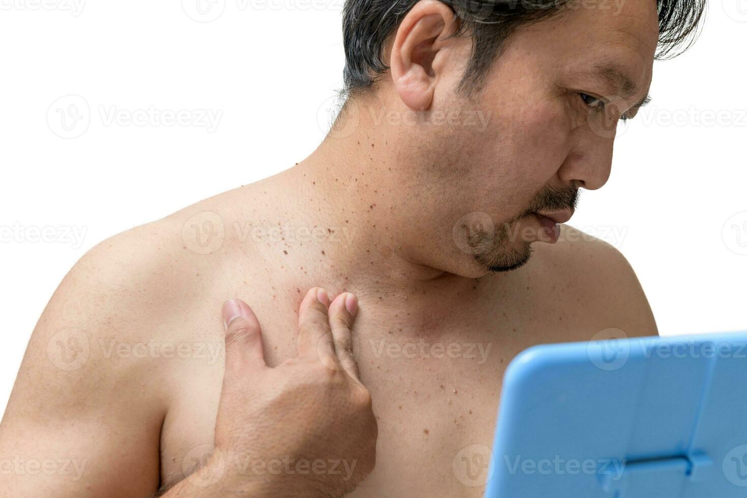 middle age senior man worry about skin tags or acrochordon on his neck isolated photo