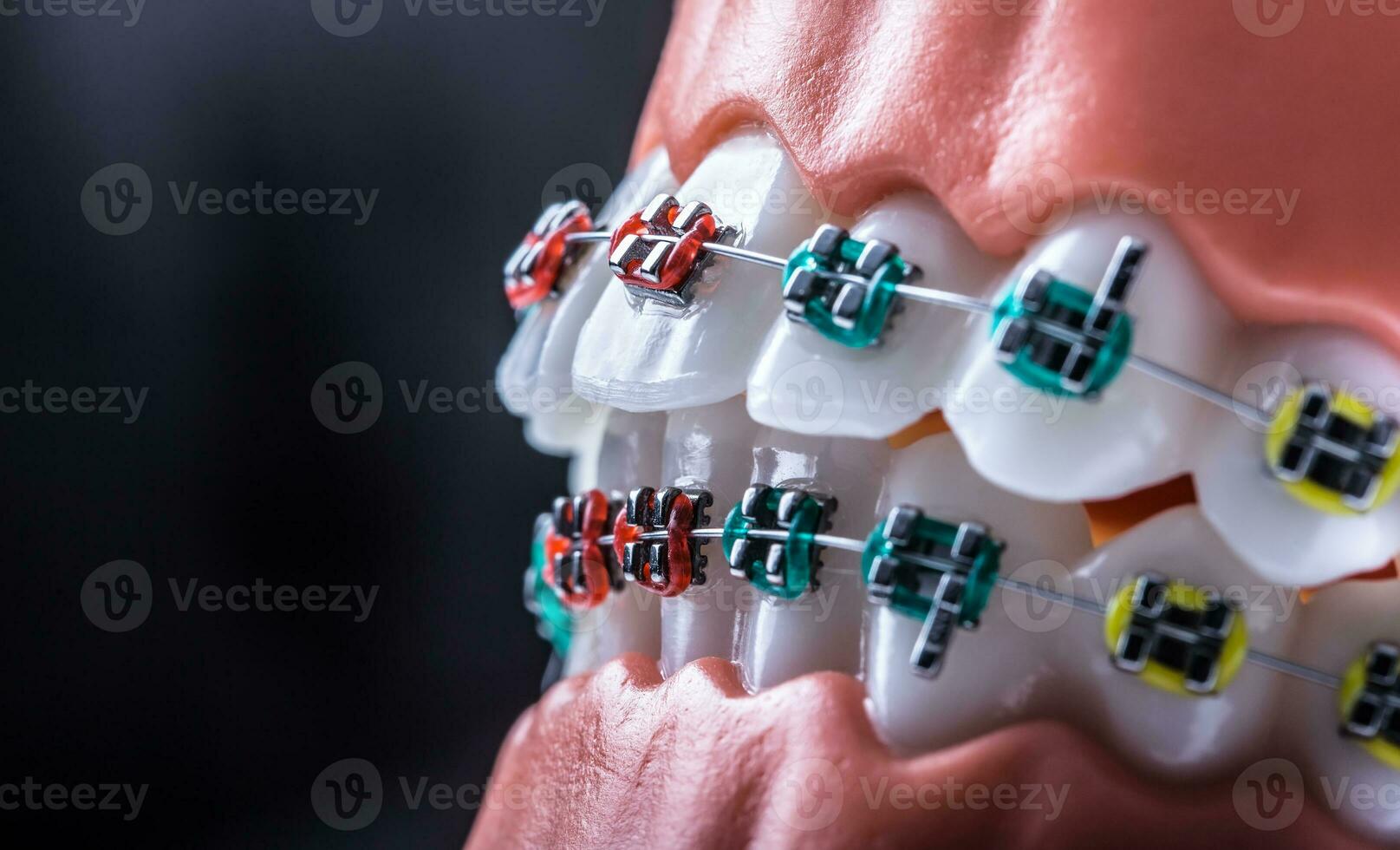 Close-up of a orthodontic model jaws and teeth with braces photo