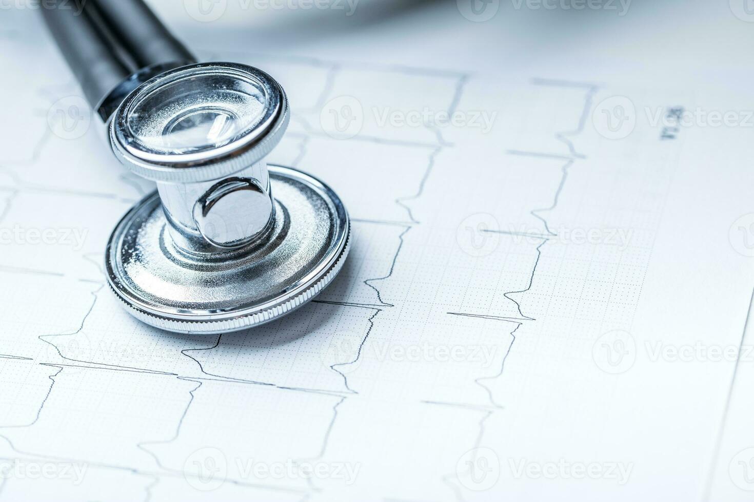 Stethoscope on a heart monitor printout.Electrocardiogram chart and stethoscope. photo