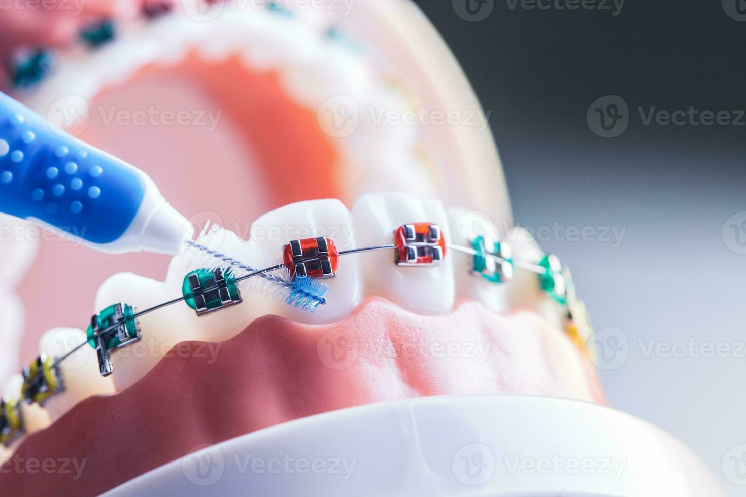 Tooth model from dental braces with inter dental teeth cleaning brush photo