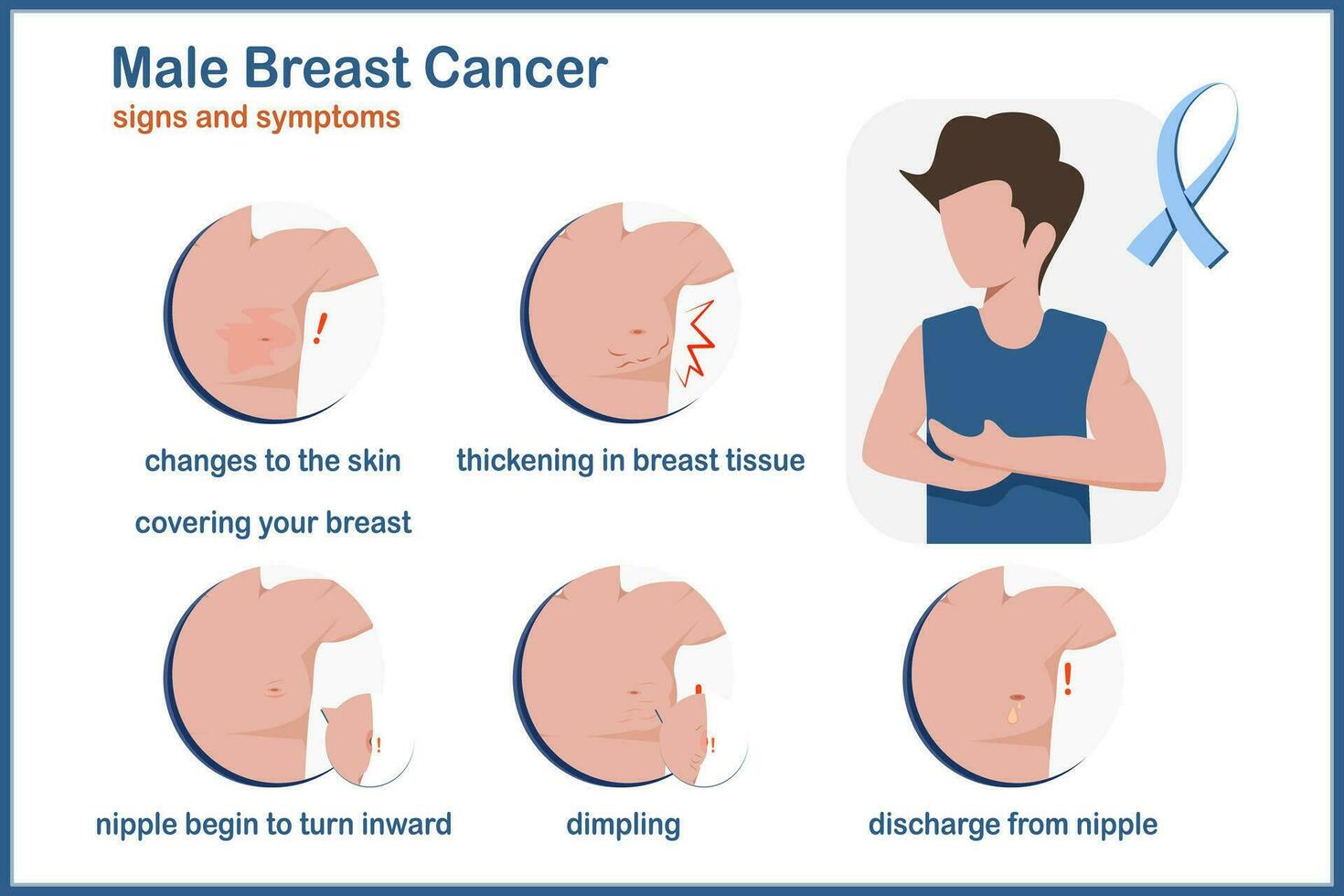 Medical vector illustration.Symptoms of breast cancer in males,thickening in your breast tissue,dimpling,a nipple that begins to turn inward and discharge from nipple.flat style.