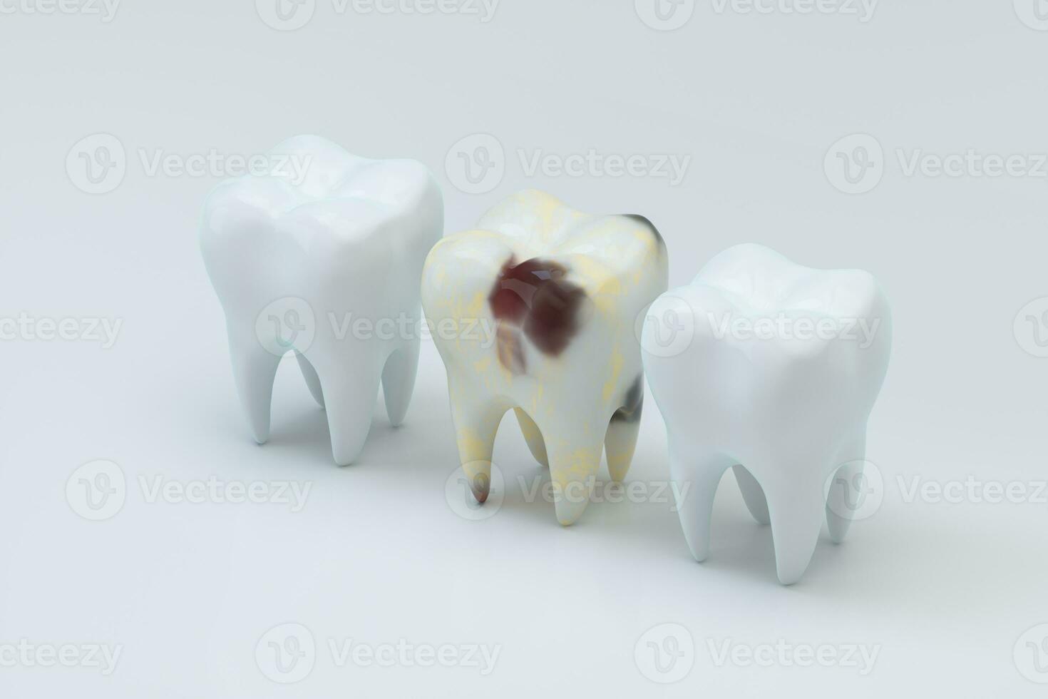 The decayed tooth beside with the white tooth, 3d rendering. photo