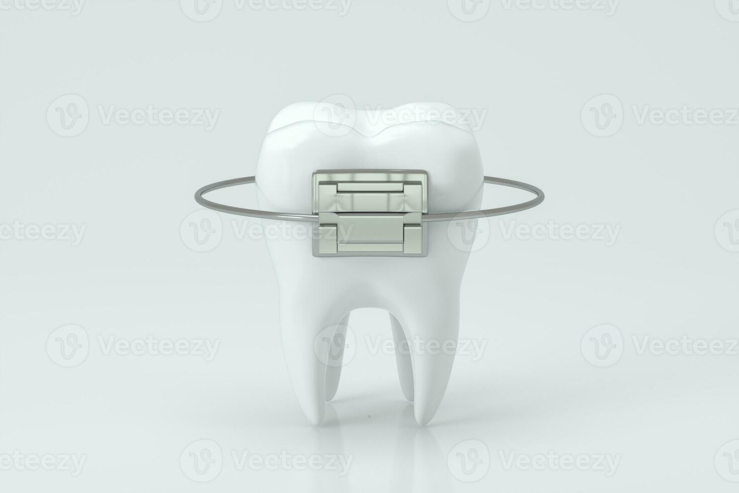 Dental braces and the teeth, 3d rendering. photo