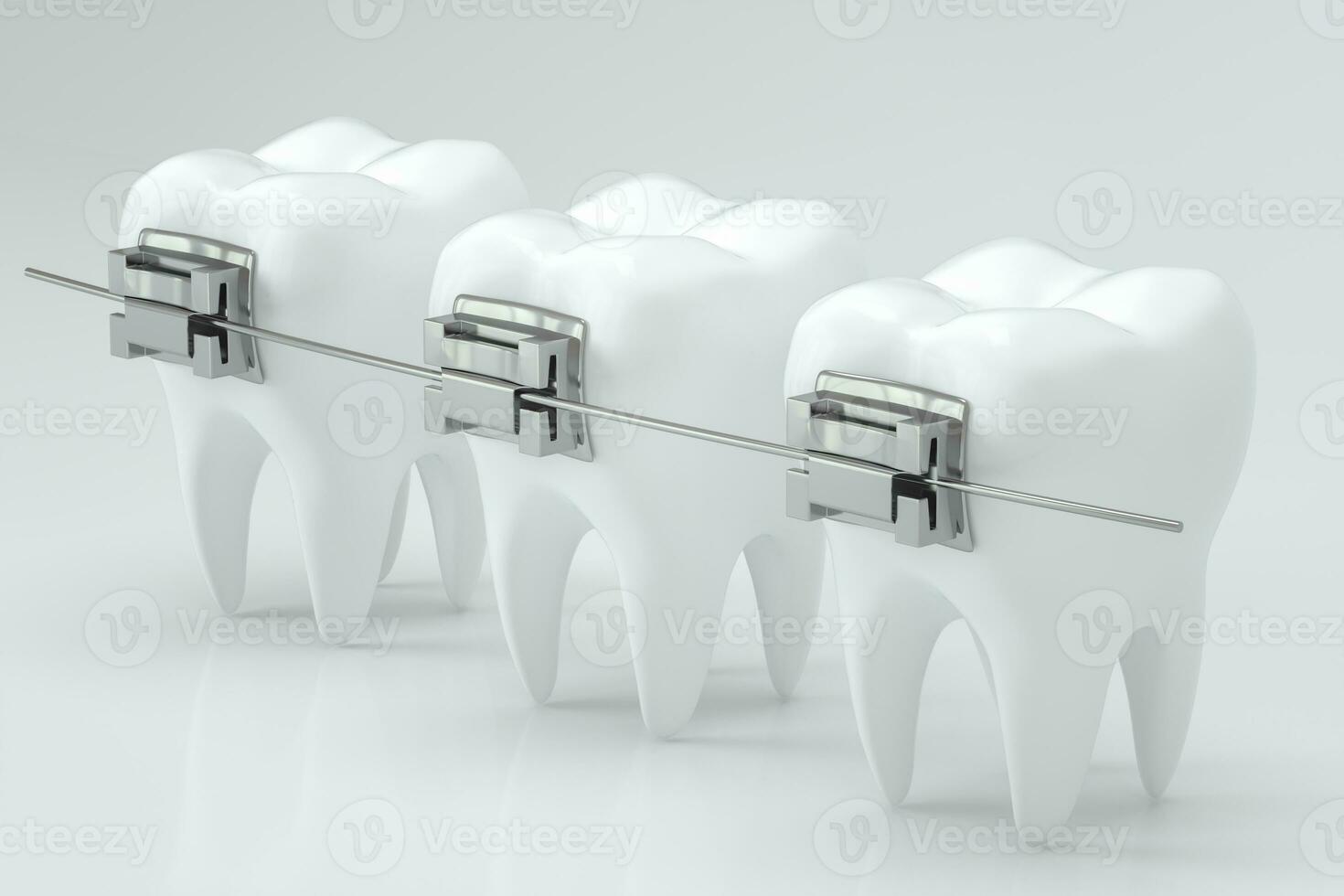 Dental braces and the teeth, 3d rendering. photo