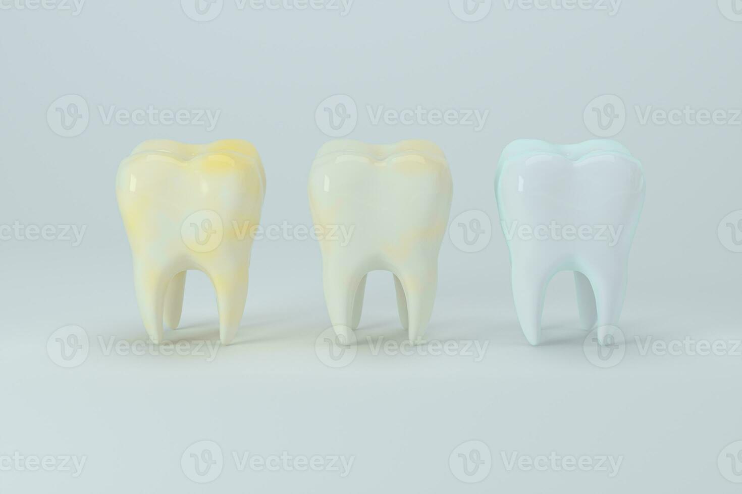 Changing of the tooth color from yellow to white, 3d rendering. photo