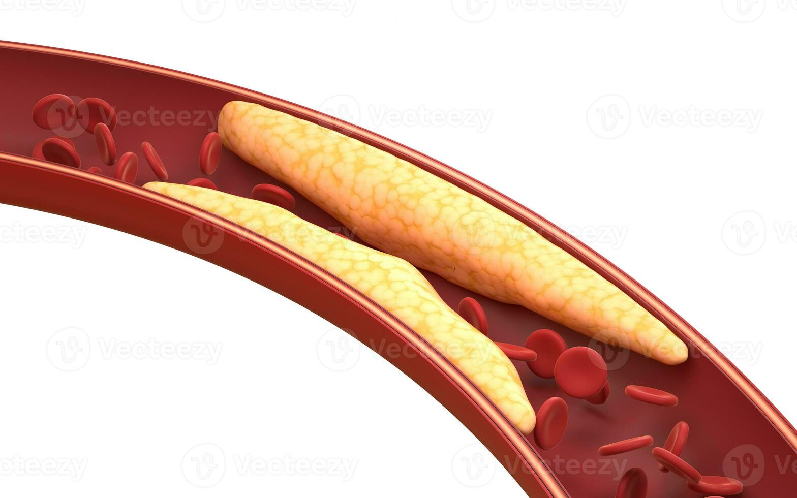 Fat and red blood cells in blood vessels, 3d rendering. photo