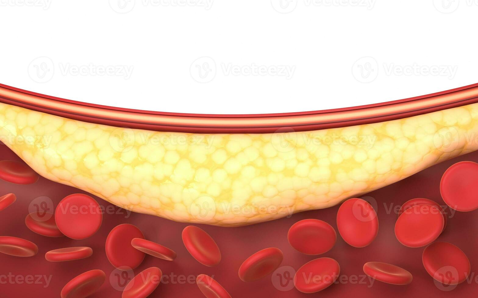 Fat and red blood cells in blood vessels, 3d rendering. photo
