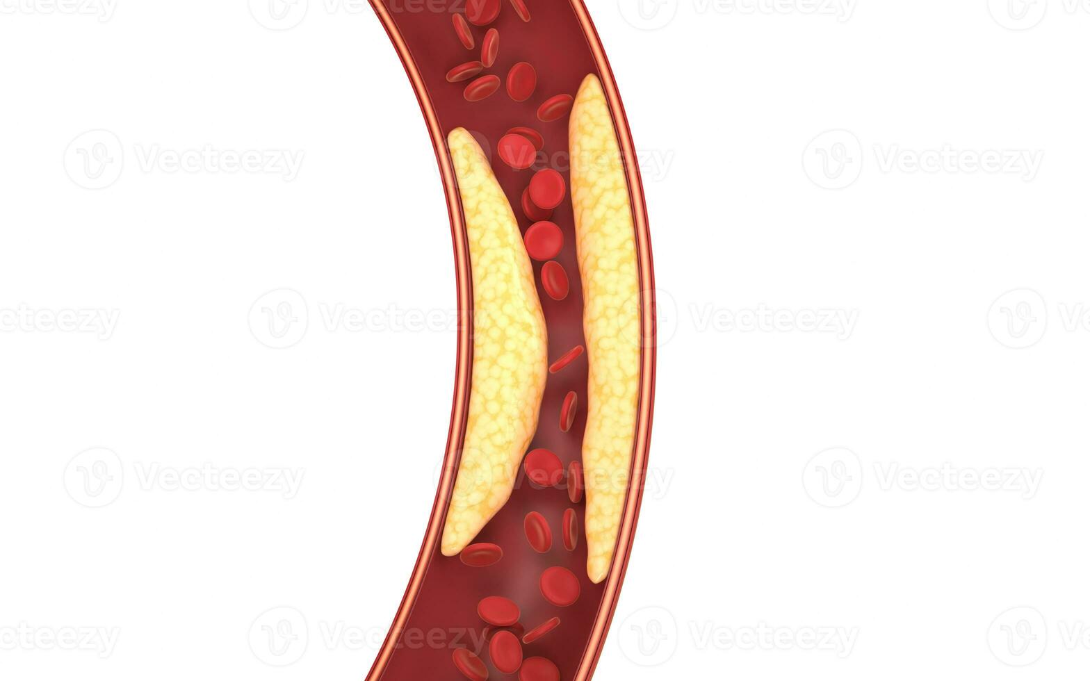 Fat and red blood cells in blood vessels, 3d rendering. photo