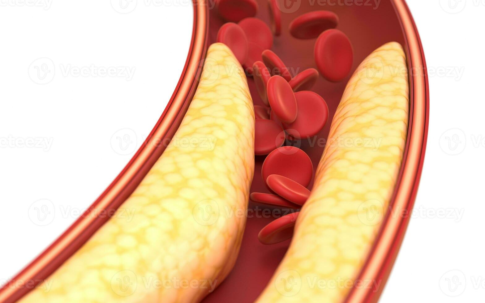 Fat and red blood cells in blood vessels, 3d rendering. photo
