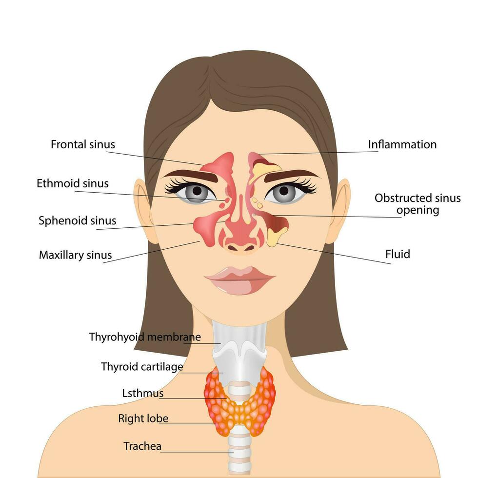 Sinusitis, Woman's face with inflammation of the mucous membrane of the paranasal and frontal sinuses. Front view of the thyroid gland and trachea on a white background. Human body organs anatomy vector