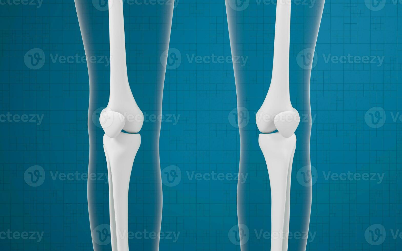 Leg bones and knees, 3d rendering. photo