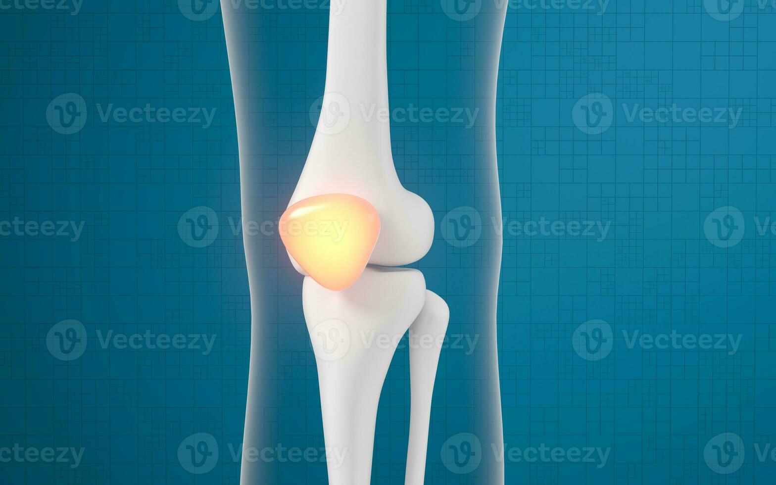 pierna hueso y rodilla lesiones, 3d representación. foto