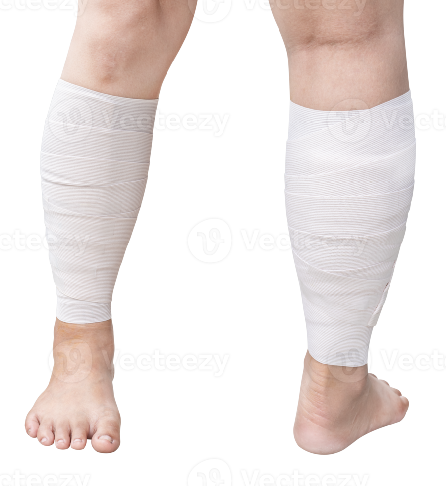 Woman had wound on her leg with bandage covered png