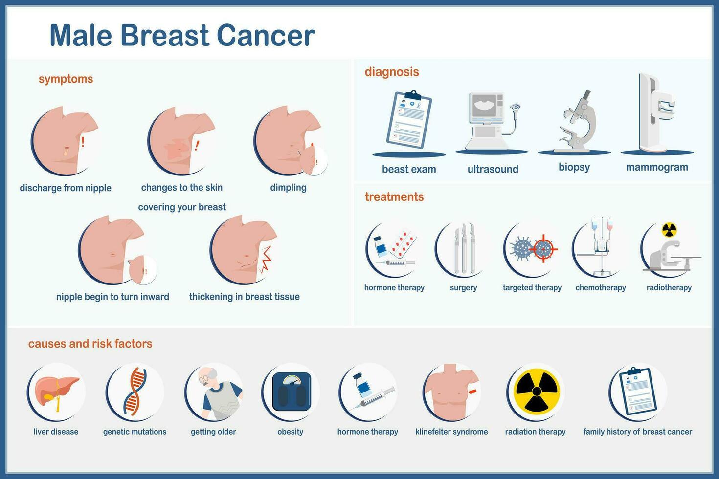 vector medical illustration,infographic Symptoms of male breast cancer,diagnosis,causes and risk factors for breast cancer.and treatment of breast cancer isolated on white background.