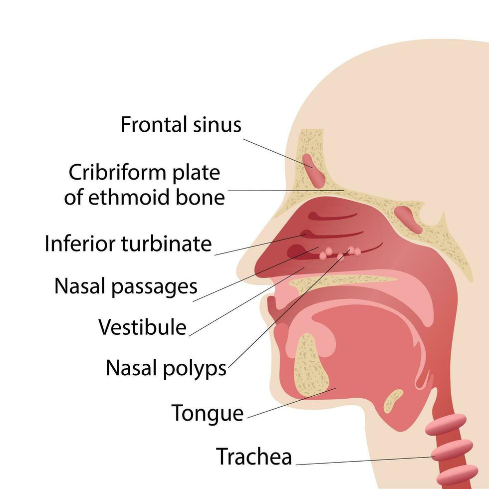 longitudinal sección de el diagrama de el anatomía de el humano nariz. pólipos de el nariz vector