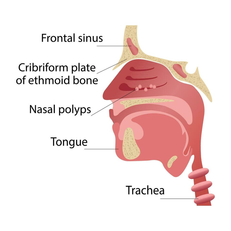 Longitudinal section of the diagram of the anatomy of the human nose. Polyps of the nose vector