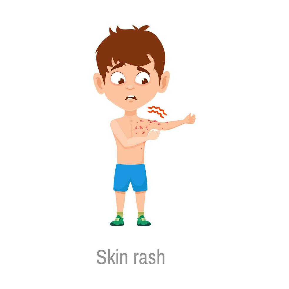 Child with skin rash disease, boy with itchy spots vector