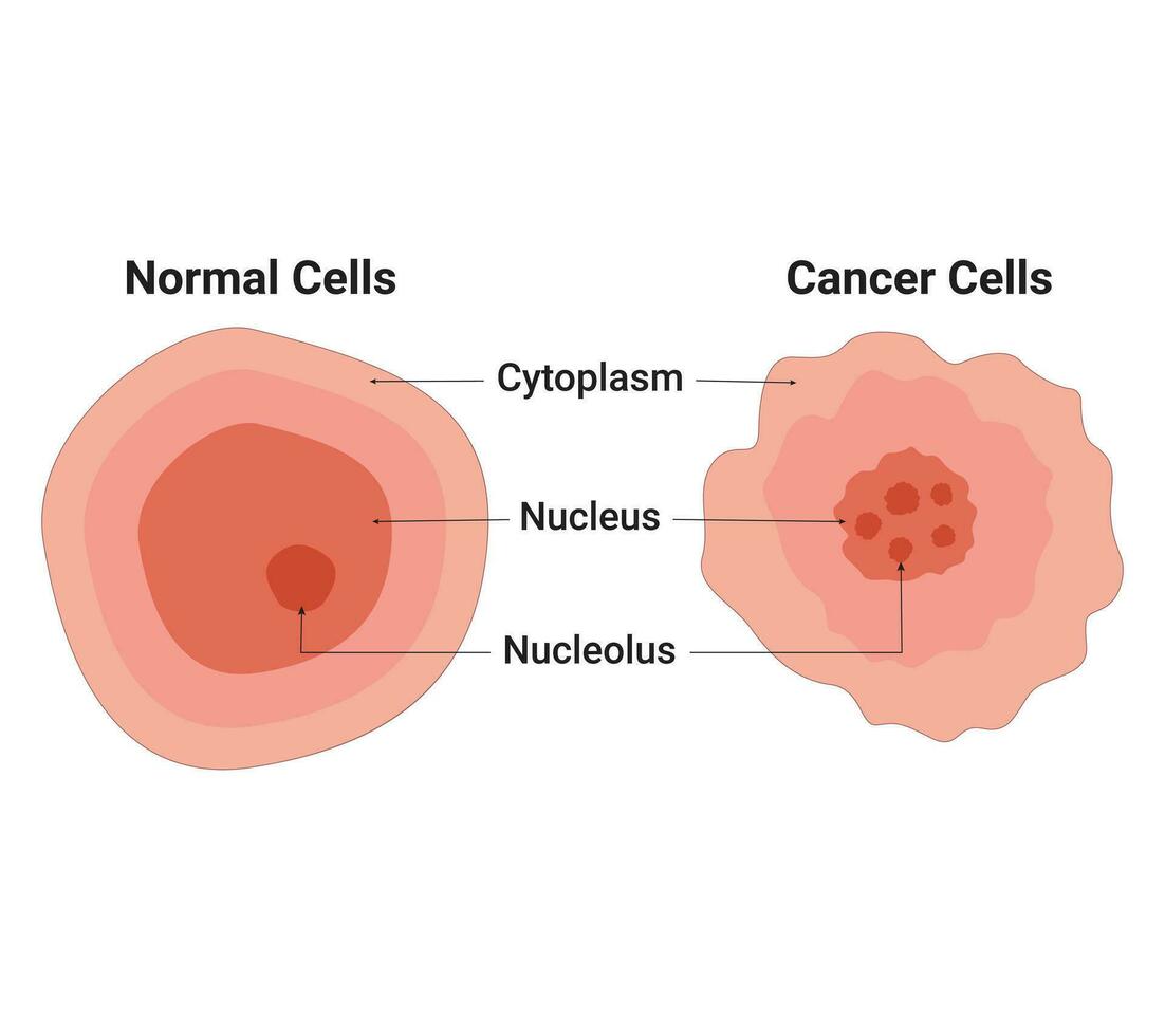 normal célula y cáncer célula vector diseño