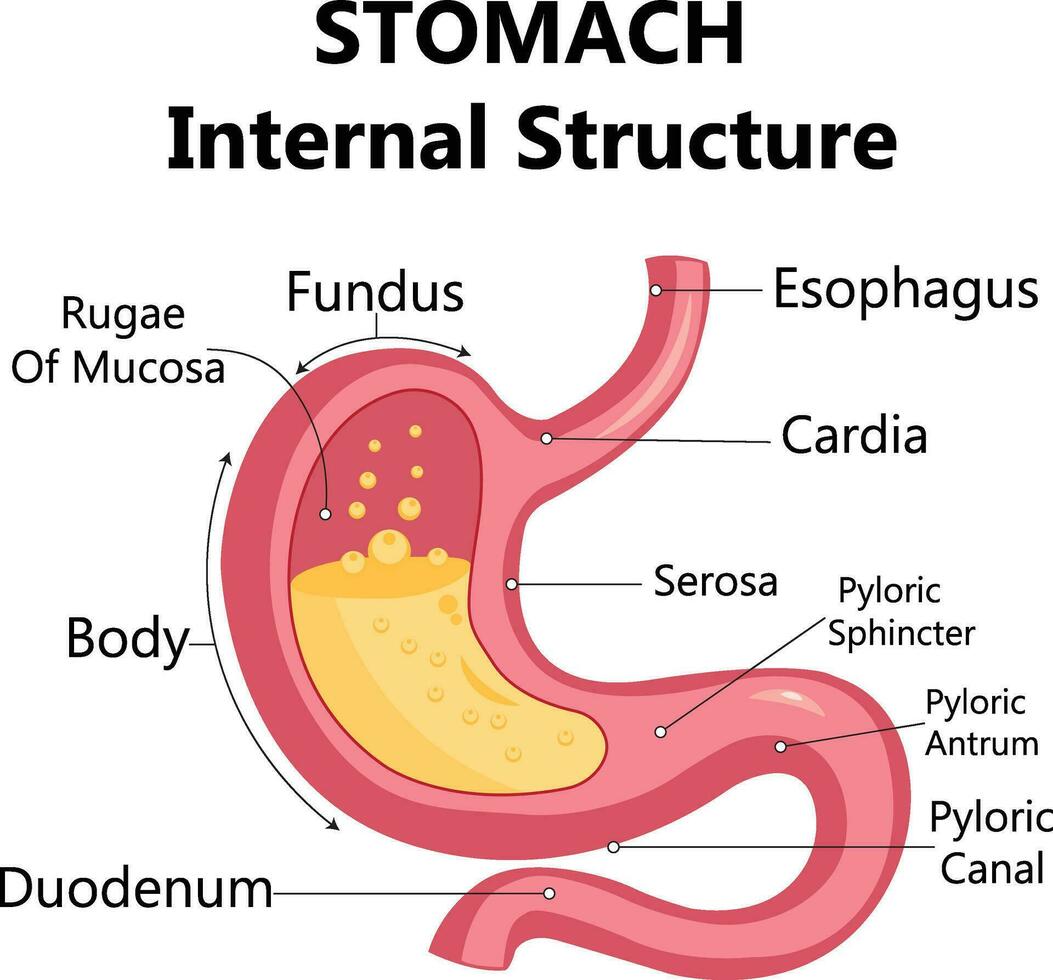 Gastroesophageal reflux disease stomach with main parts labeled. Medical vector illustration with the shape of a sick human body, fragments of healthy and sick stomach isolated on a white background